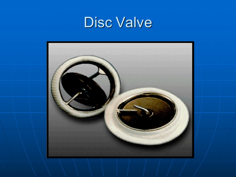 Disc Valve